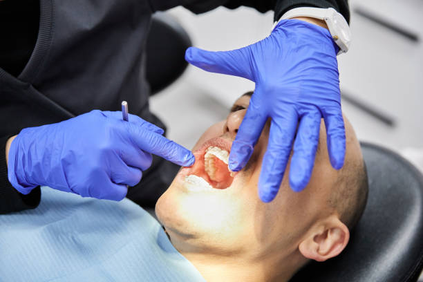Best Emergency Root Canal Treatment in Glasgow, MO