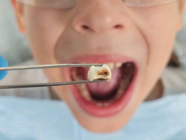 Best Emergency Dentist for Special Needs Patients in Glasgow, MO